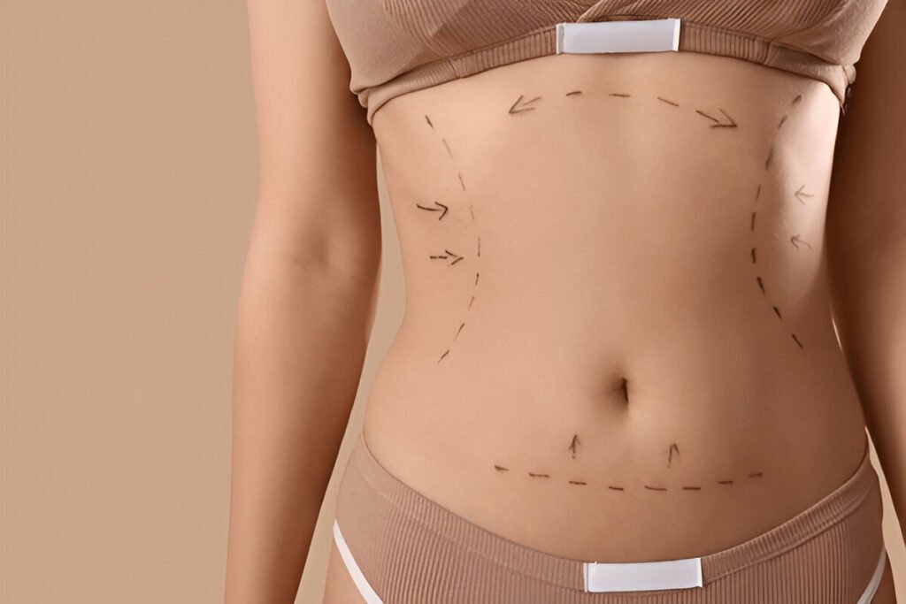 The Complete Recovery Guide After Abdominoplasty: Tips for a Smooth Healing Journey