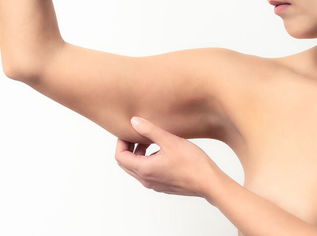 Todo lo que debes saber sobre la cirugía de lifting de brazos en Estambul