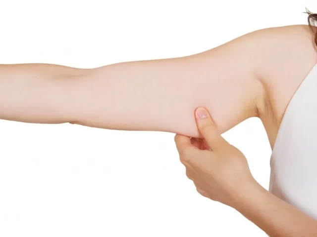 Tout ce qu’il faut savoir sur la chirurgie de lifting des bras à Istanbul